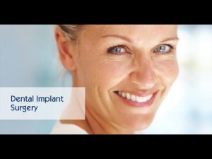 Dental Implant Surgery thumbnail